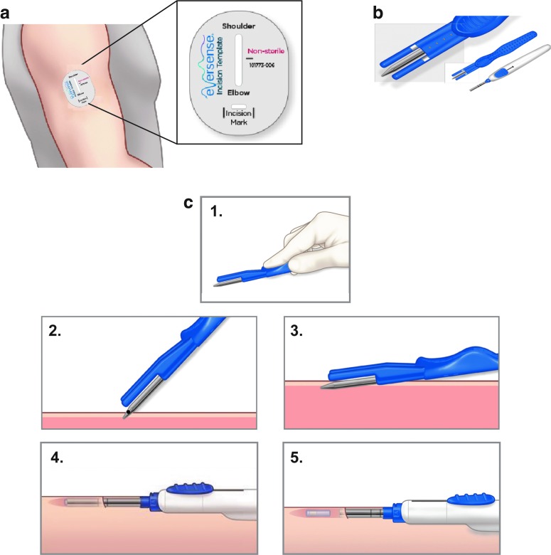 FIG. 3.