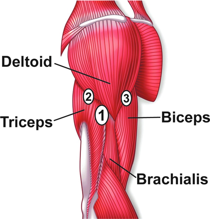 FIG. 2.