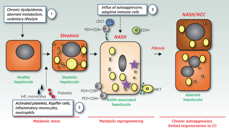 NASH and Hepatocellular Carcinoma: Immunology and Immunotherapy - PMC