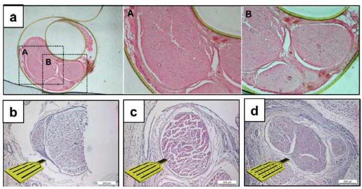 Figure 14