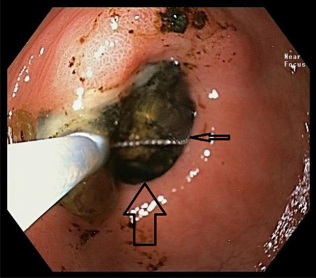 Fig. 3