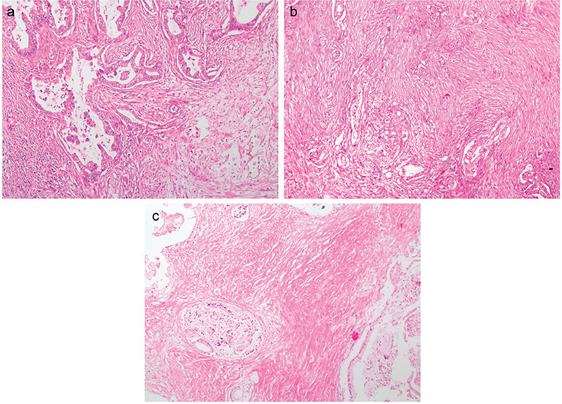 Figure 3a-c