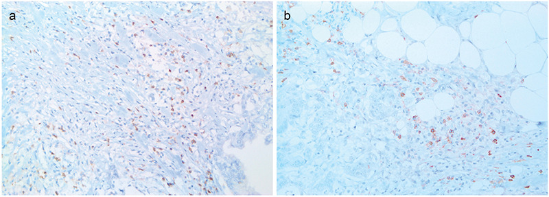 Figure 1a,b