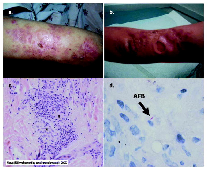 Fig. 4