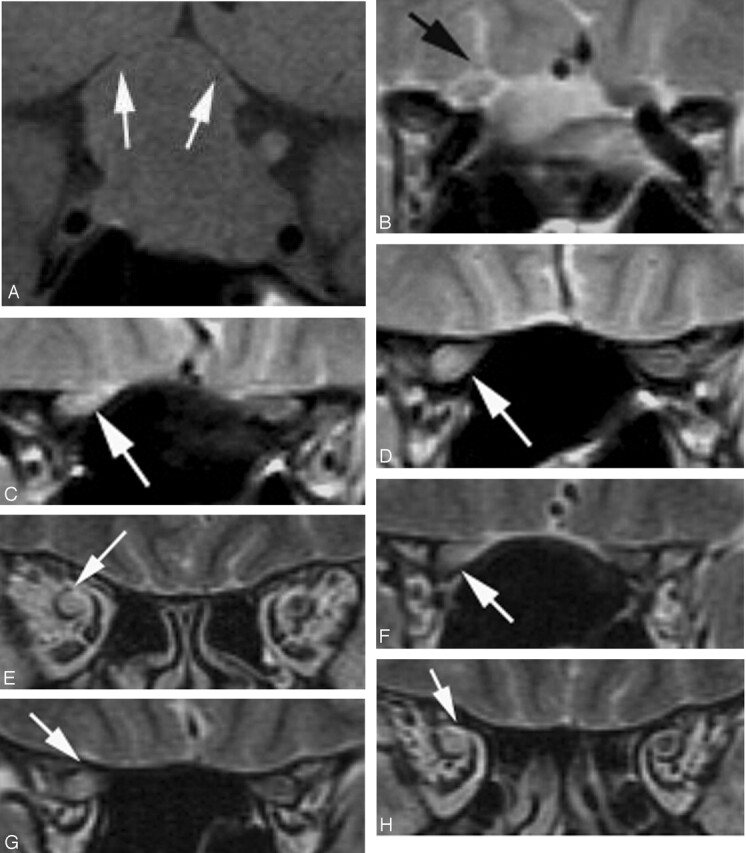 Fig 5.