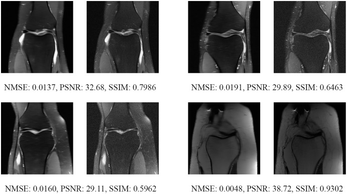 Figure 18