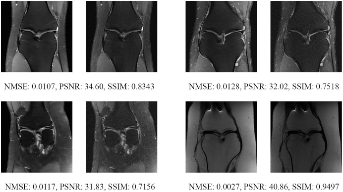 Figure 15