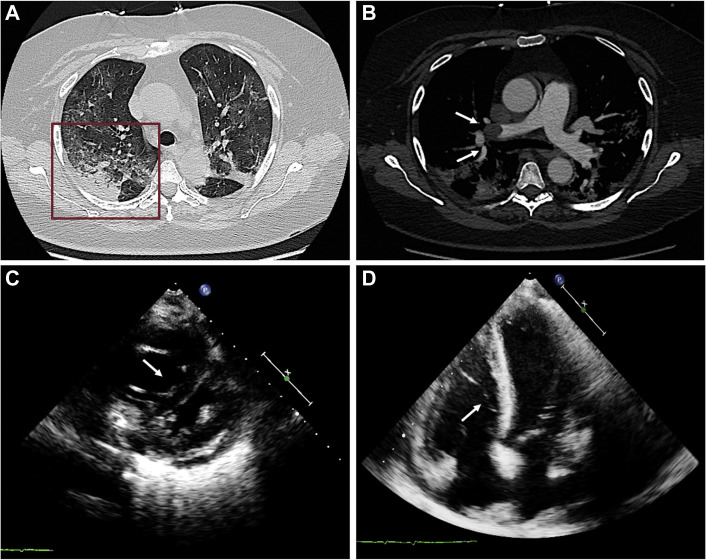 Figure 4