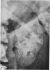 892-3