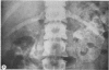892-3