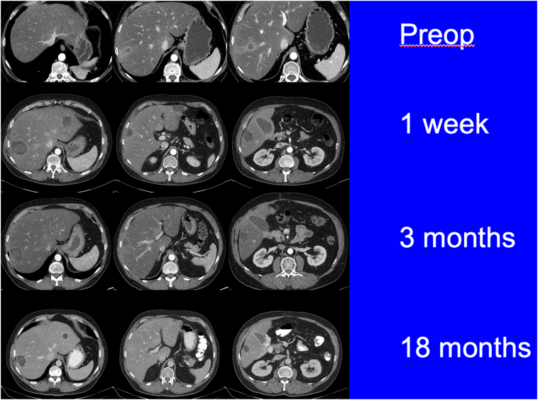 Fig 12