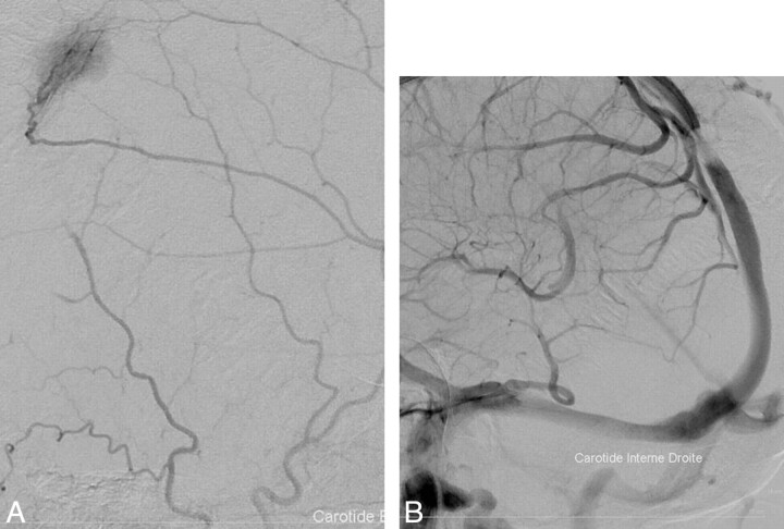 Fig 2.