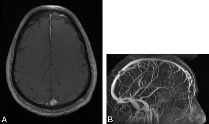 Fig 1.