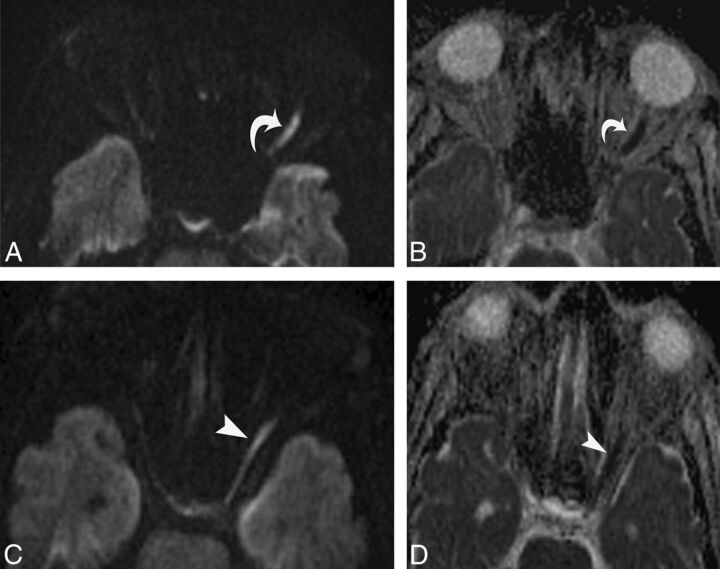 Fig 2.