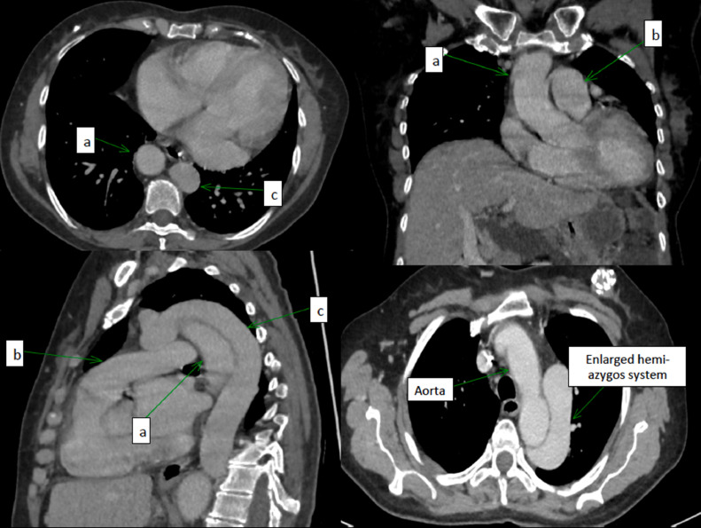 Fig 2