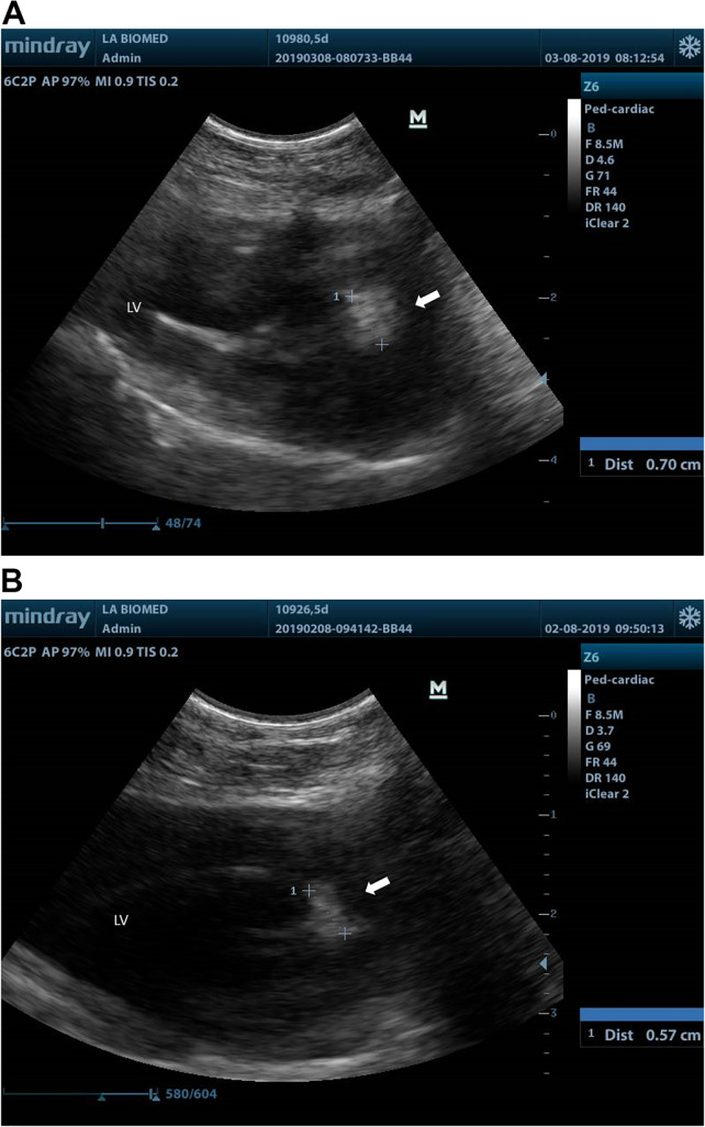 FIG 1