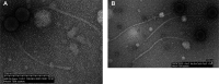 FIG 1