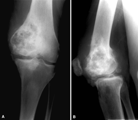 Fig. 1A–B