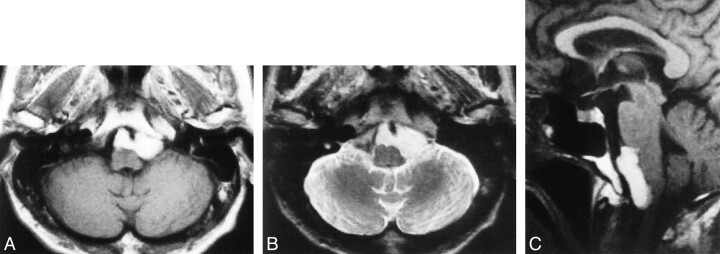 fig 1.