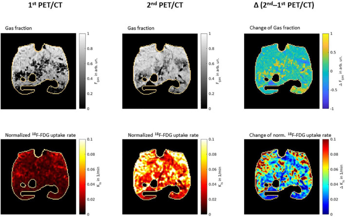 Mechanical Power Correlates With Lung Inflammation Assessed By Positron