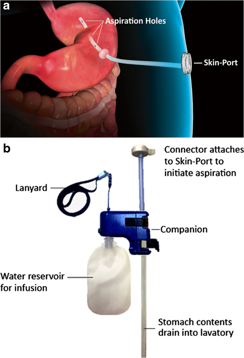 Fig. 1