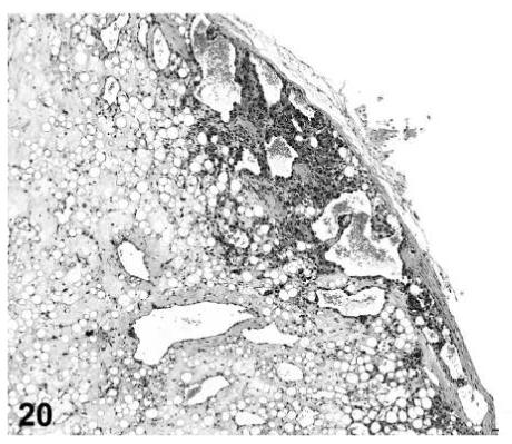 FIGURE 20