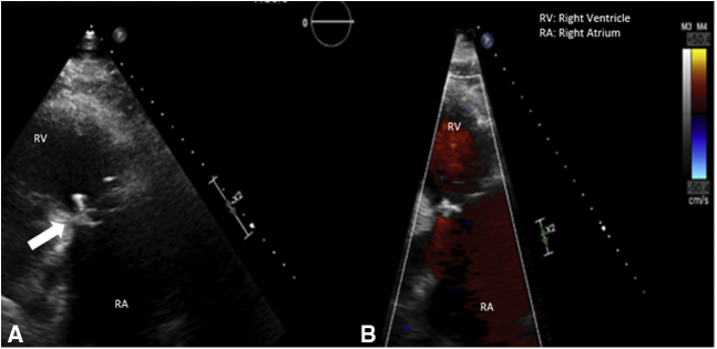 Figure 2