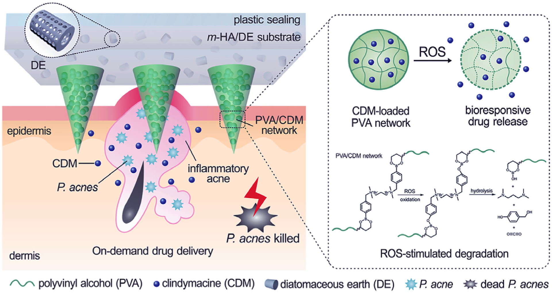 Stimuli-responsive transdermal microneedle patches - PMC