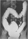 261