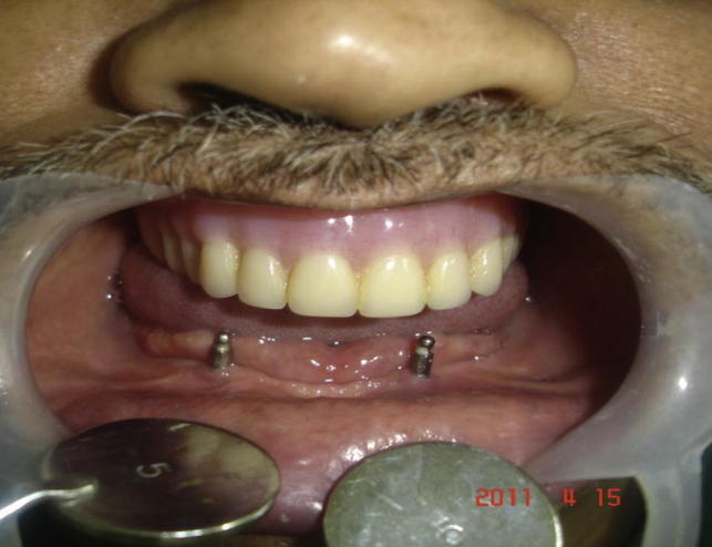 Fig. 1
