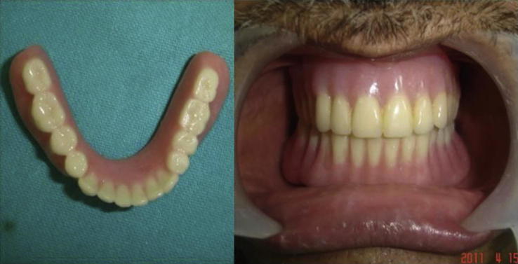 Fig. 4