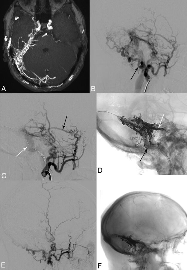 Fig 2.