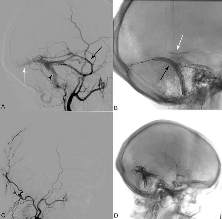 Fig 3.