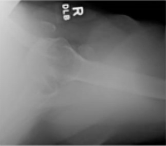 Figure 12