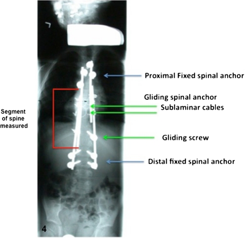 Fig. 4