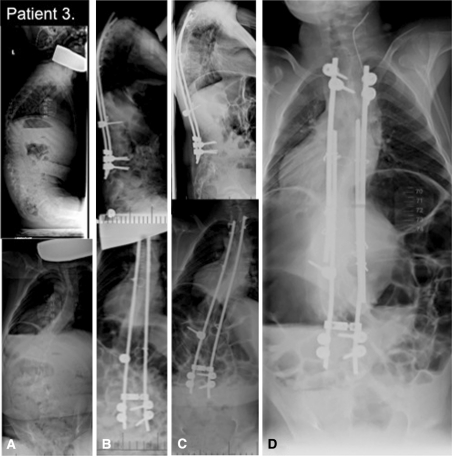 Fig. 6A–D