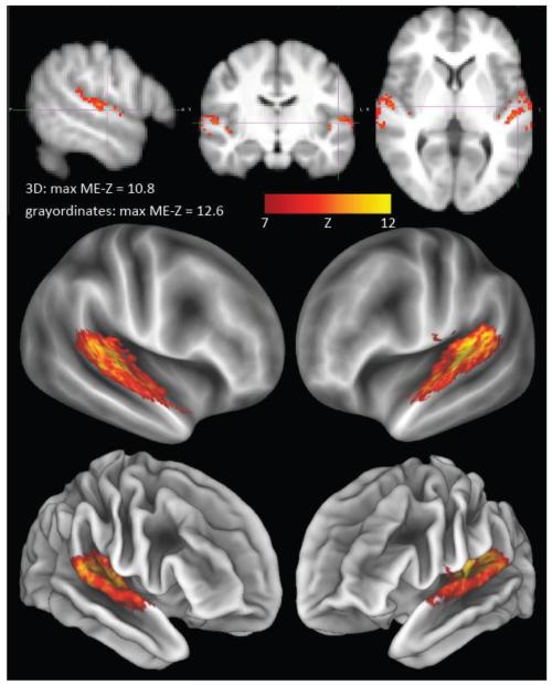 Fig 12