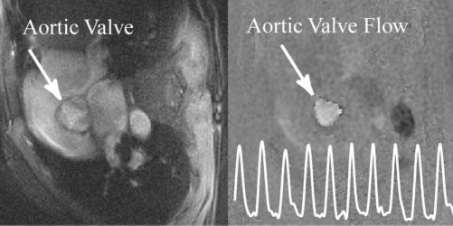 FIG. 4