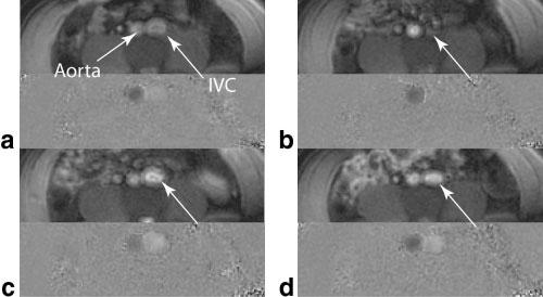 FIG. 5