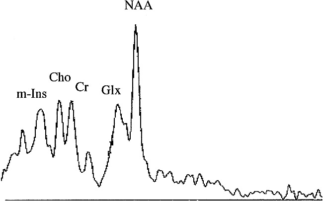 fig 1.