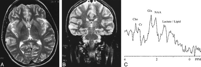 fig 3.