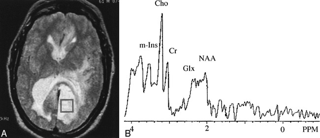 fig 2.