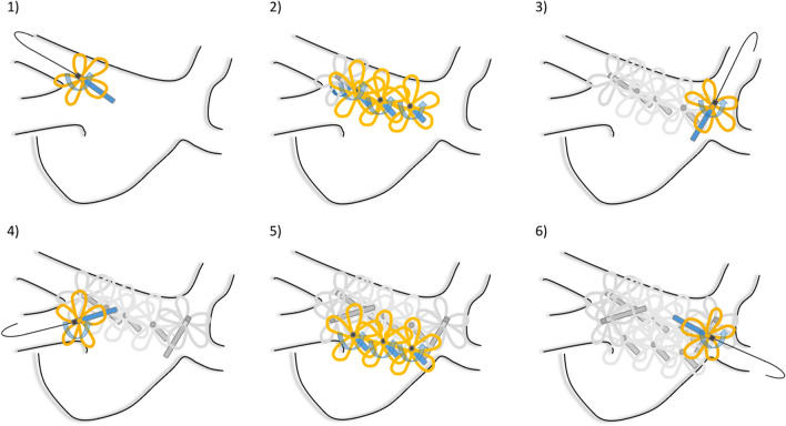 Fig. 1