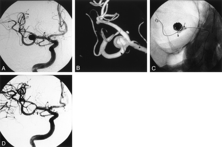 Fig 2.