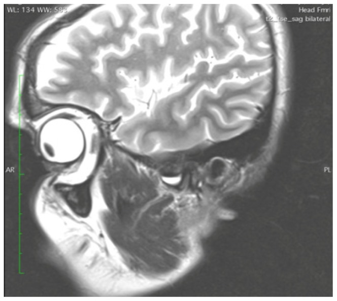 Figure 10