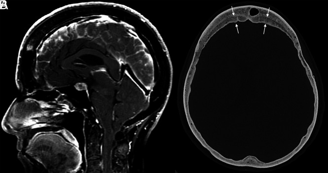 FIG 3.