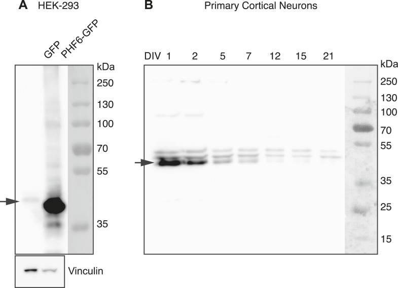 Figure 5—figure supplement 3.