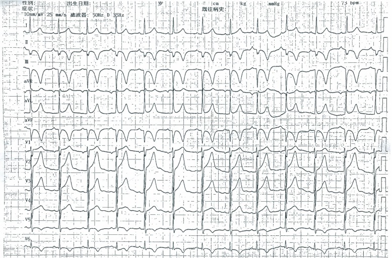 Fig. 3