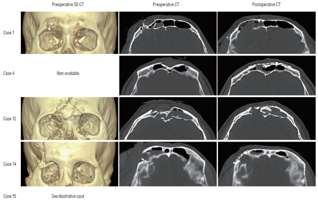 Fig. 4.