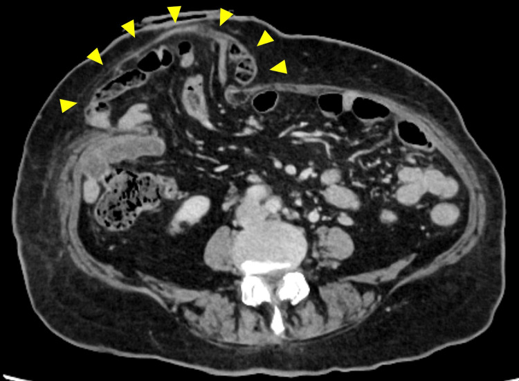 Figure 10